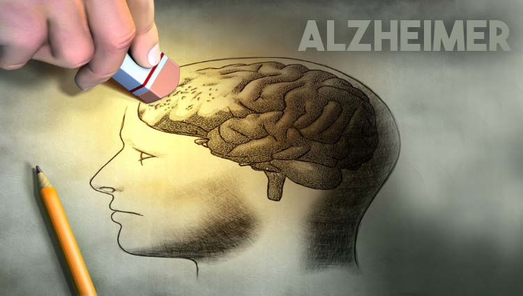 El Alzheimer.
